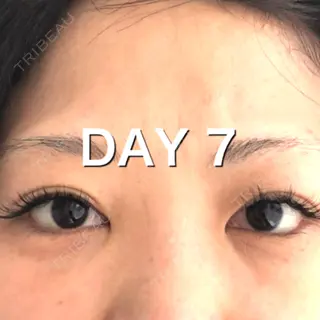 7日目の経過画像（1枚目）