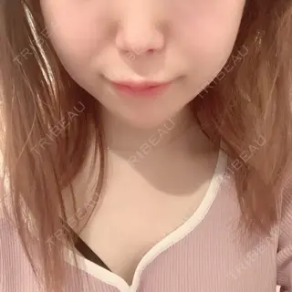 160日目の経過画像（1枚目）