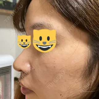 8日目の経過画像（2枚目）