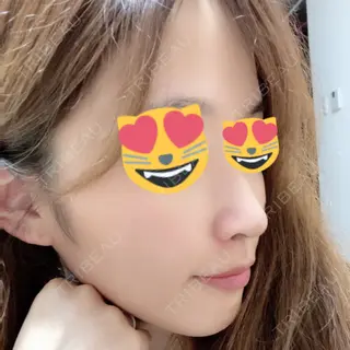 32日目の経過画像（1枚目）