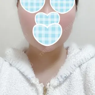7日目の経過画像（3枚目）