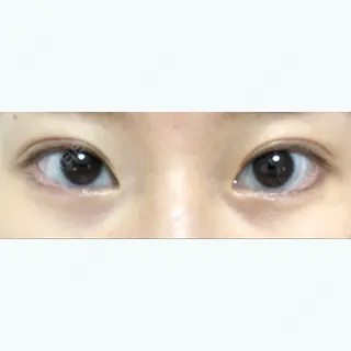 178日目の経過画像（1枚目）