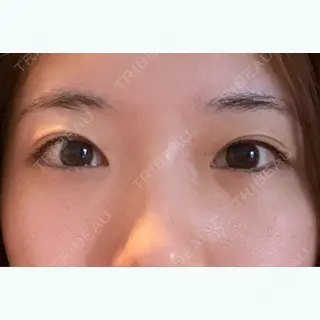 9日目の経過画像（1枚目）