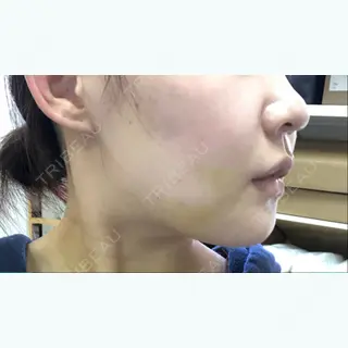 9日目の経過画像（2枚目）