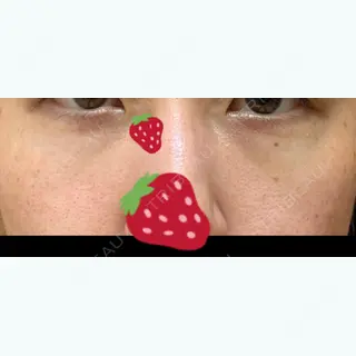 37日目の経過画像（1枚目）