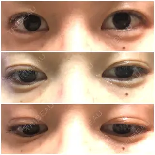 47日目の経過画像（1枚目）
