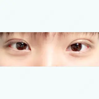 7日目の経過画像（1枚目）