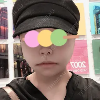 1日目の経過画像（1枚目）