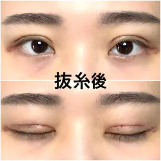 8日目の経過画像（2枚目）
