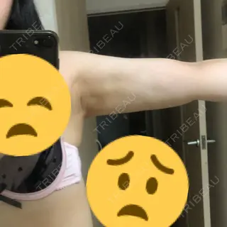 32日目の経過画像（2枚目）