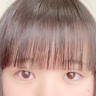 3日目の経過画像（1枚目）