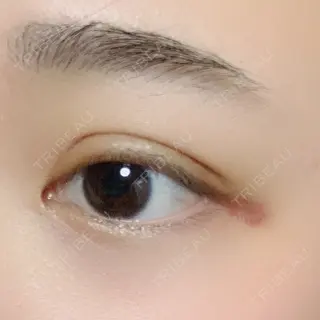 9日目の経過画像（1枚目）