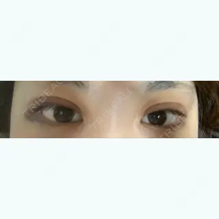 1日目の経過画像（3枚目）