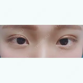 10日目の経過画像（1枚目）