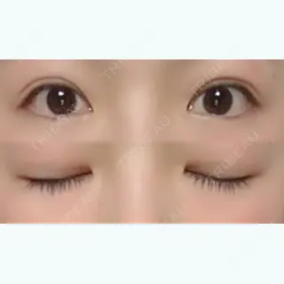 199日目の経過画像（1枚目）