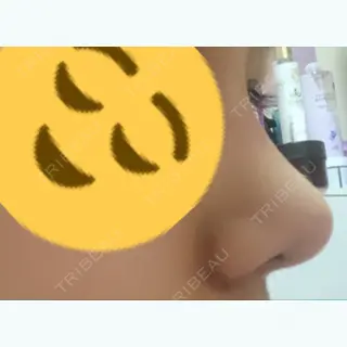 121日目の経過画像（1枚目）