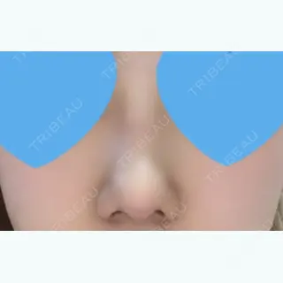 121日目の経過画像（2枚目）