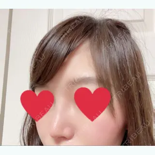 31日目の経過画像（2枚目）