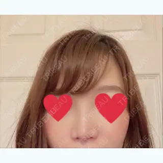 10日目の経過画像（1枚目）
