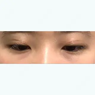 9日目の経過画像（2枚目）
