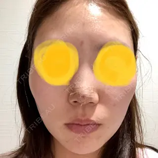 1日目の経過画像（1枚目）