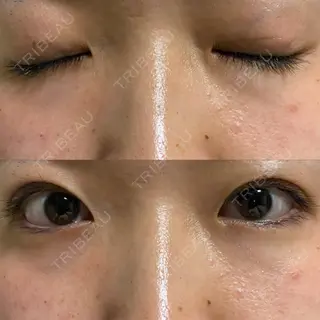 10日目の経過画像（3枚目）