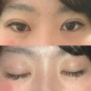 8日目の経過画像（1枚目）