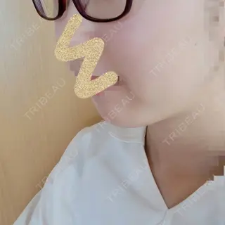 4日目の経過画像（2枚目）