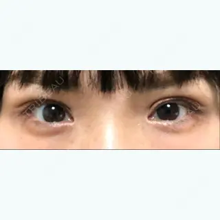 68日目の経過画像（1枚目）