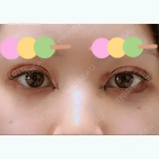 5日目の経過画像（1枚目）