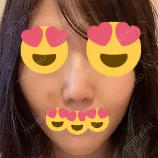 67日目の経過画像（1枚目）