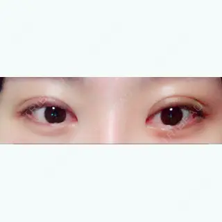149日目の経過画像（1枚目）
