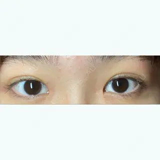 50日目の経過画像（1枚目）