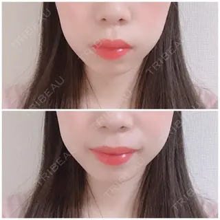 8日目の経過画像（1枚目）