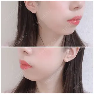 8日目の経過画像（2枚目）
