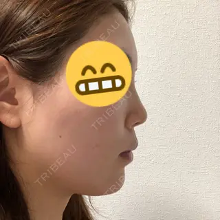 4日目の経過画像（3枚目）