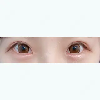 55日目の経過画像（1枚目）