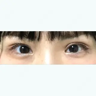 70日目の経過画像（1枚目）