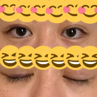 2日目の経過画像（1枚目）