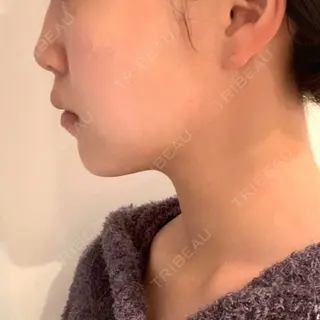 2日目の経過画像（3枚目）