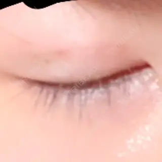 20日目の経過画像（3枚目）