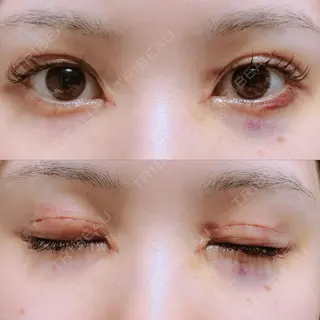 7日目の経過画像（1枚目）