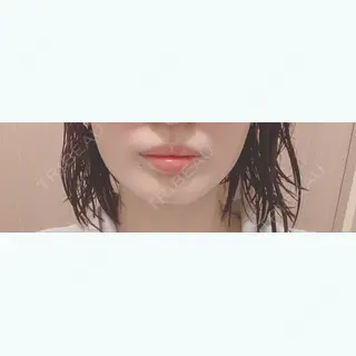 48日目の経過画像（1枚目）