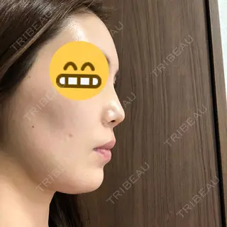 6日目の経過画像（3枚目）