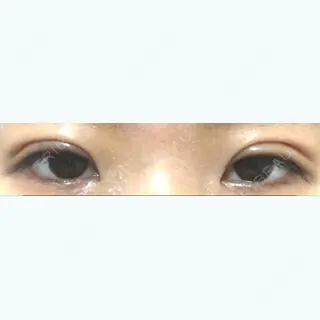 142日目の経過画像（1枚目）