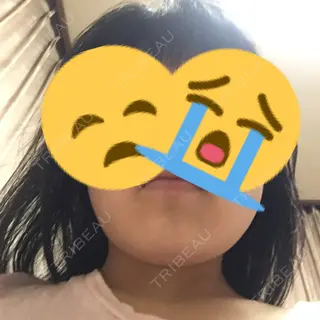 21日目の経過画像（3枚目）