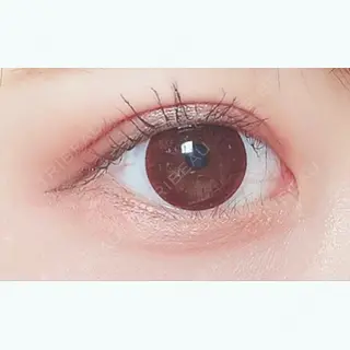 62日目の経過画像（1枚目）