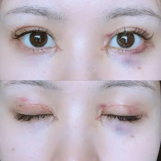 9日目の経過画像（1枚目）
