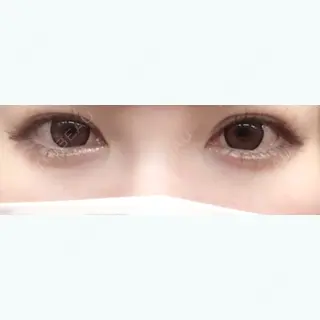 19日目の経過画像（1枚目）