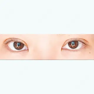 6日目の経過画像（1枚目）